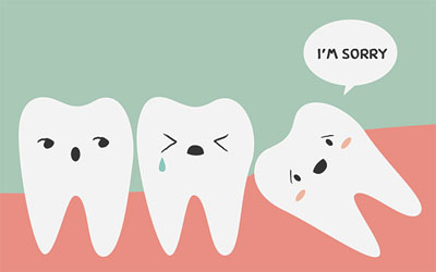 Should I Have My Wisdom Teeth Removed?