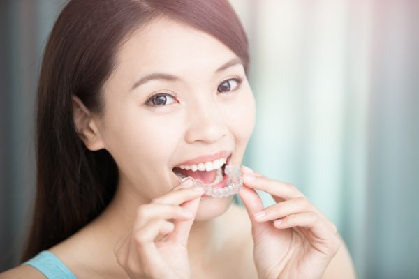 What Types Of Cosmetic Dentistry Treatments Are Available In The San Jose Area?