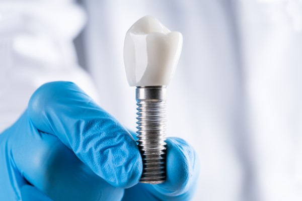 General Dentist: A Guide To Dental Implants