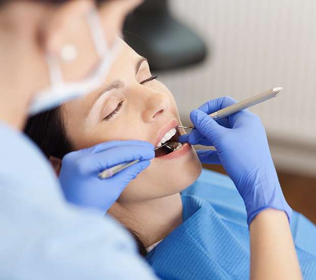 San Jose Dental Restorations