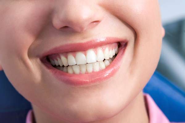 A General Dentist Discusses the Benefits of Tooth Straightening from Dennis Baik, DDS in San Jose, CA