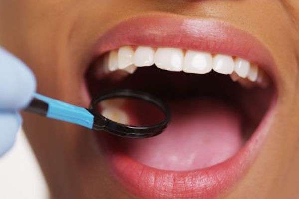 How a General Dentist Treats Cavities from Dennis Baik, DDS in San Jose, CA