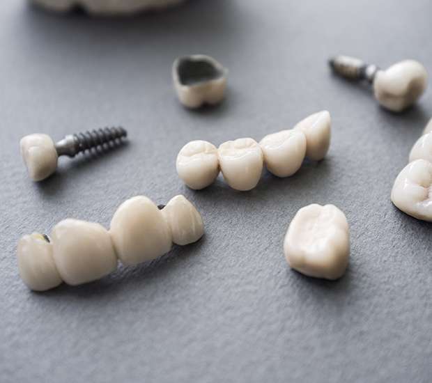 San Jose The Difference Between Dental Implants and Mini Dental Implants