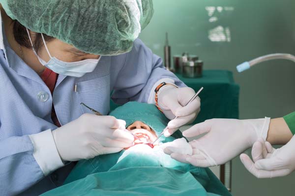 Tooth Extraction San Jose, CA